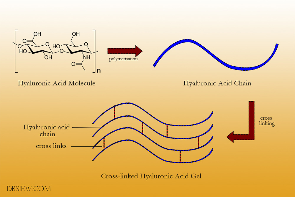 Hyaluronic Acid Dermal Filler Structure Dr Siew
