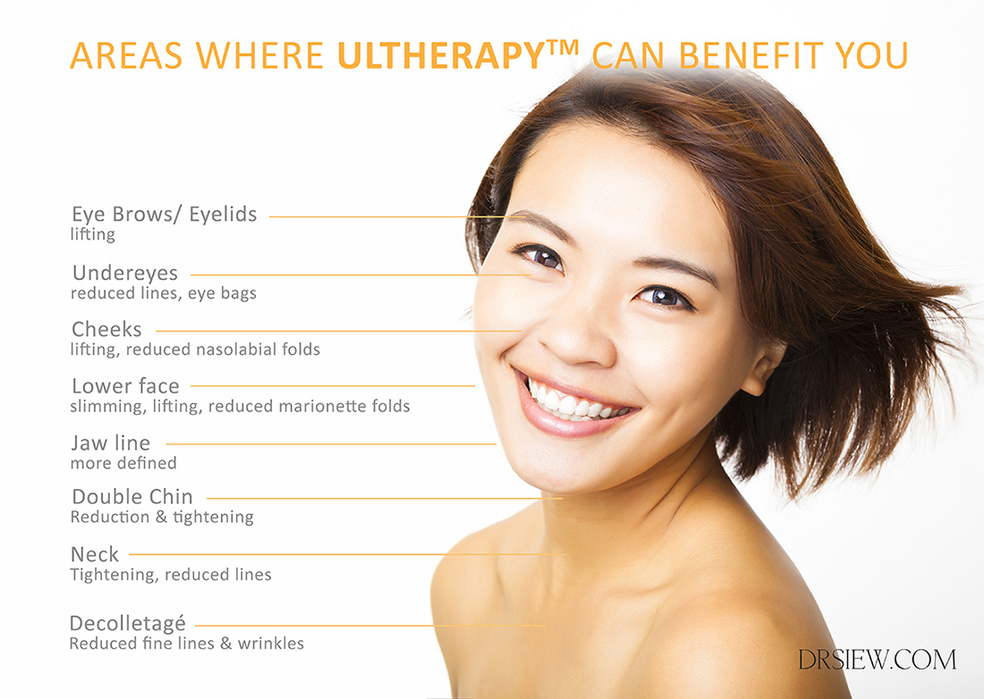 Areas Where Ultherapy Benefit Dr Siew