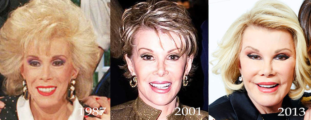 Joan Rivers through the years | Dr Siew.com