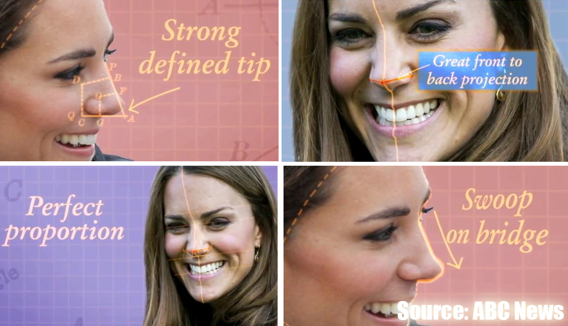 Kate Middleton beautiful Nose