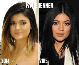 Kylie Jenner Lip Challenge:The Truth,The Danger,The Fillers