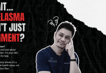 The Science Behind Melasma