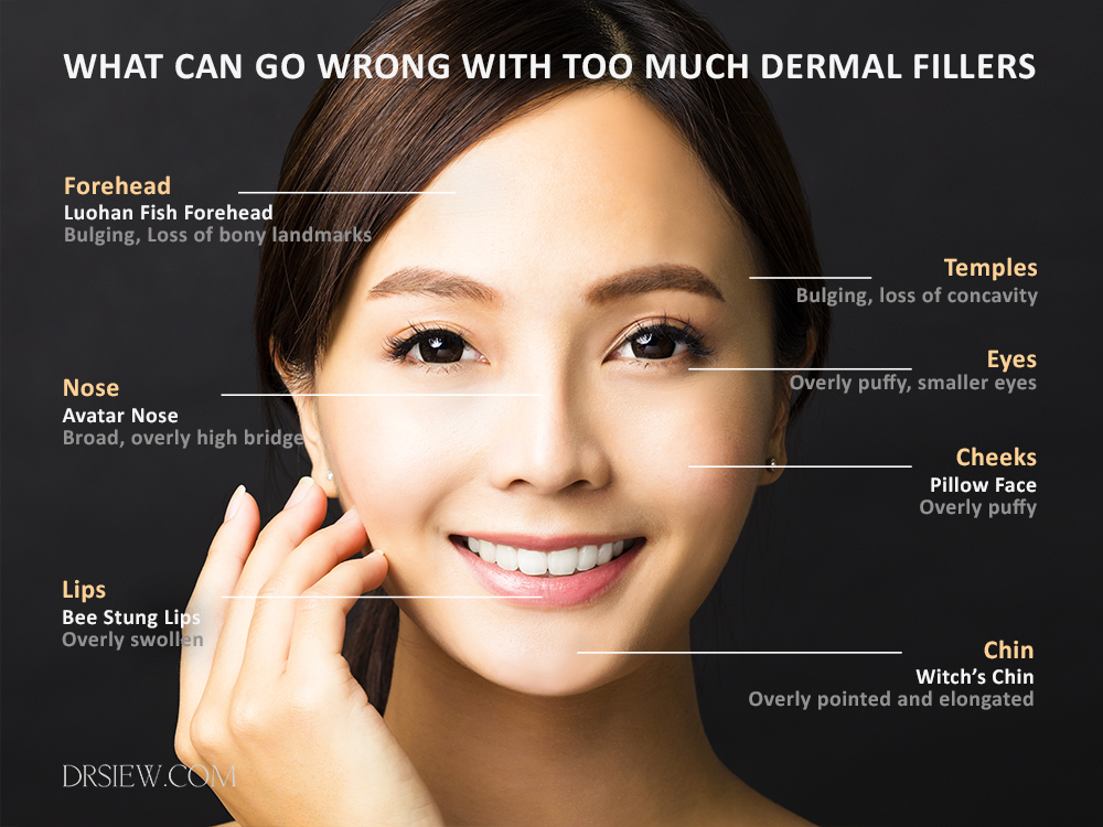 Dermal Filler for Facial Augmentation How Much Is Enough? Dr. Siew