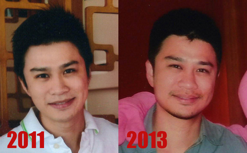 Dr Siew before after 2013