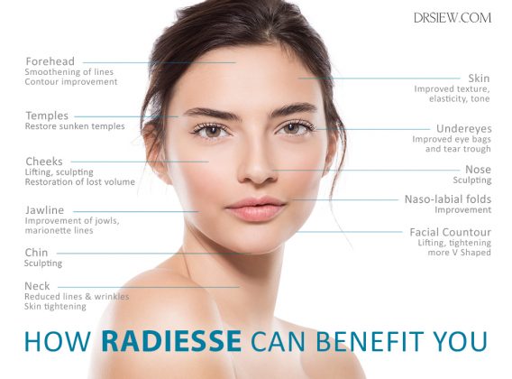 RADIESSE: The Most Versatile Filler for Lifting & Rejuvenation | Dr Siew