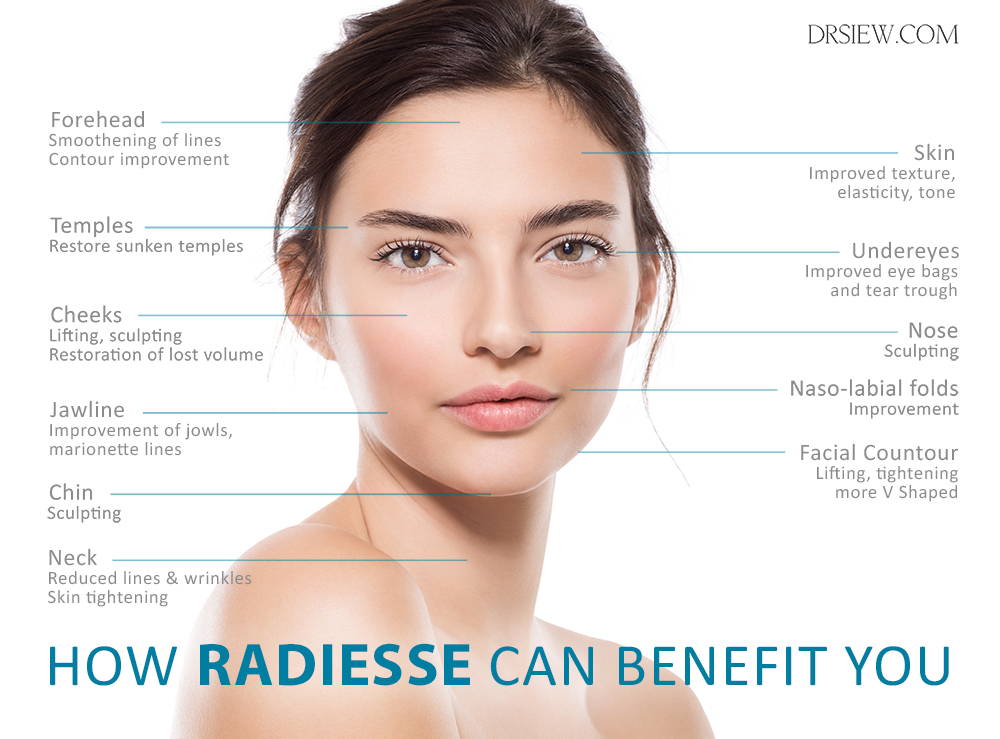 Areas where RADIESSE can benefit you Dr Siew