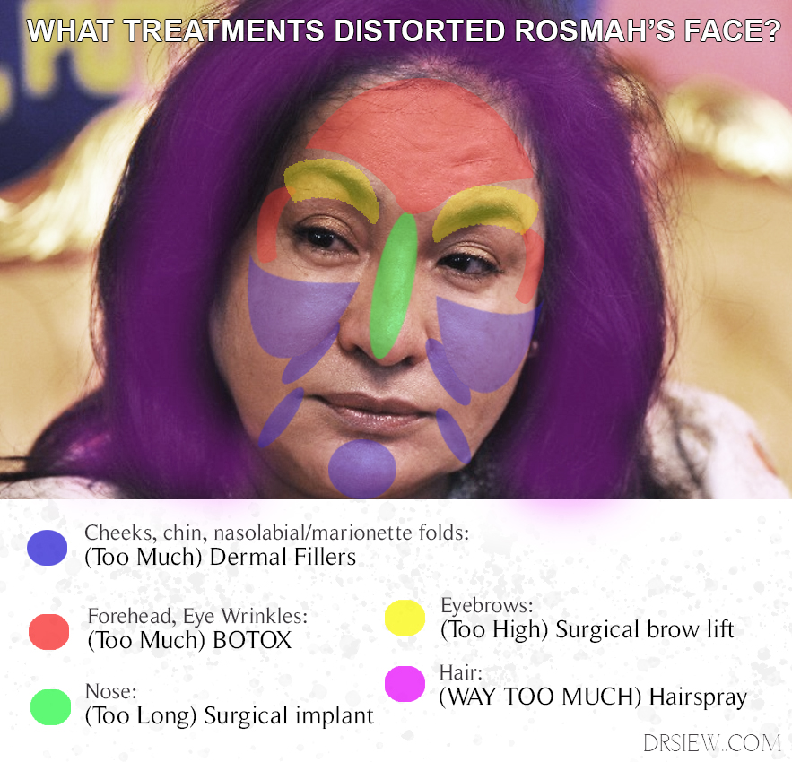 Rosmah Bad Plastic Surgery Treatments