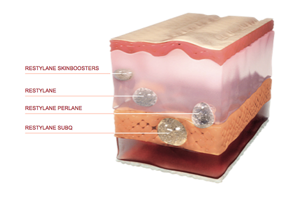 Skinboosters different Restylane Dr Siew