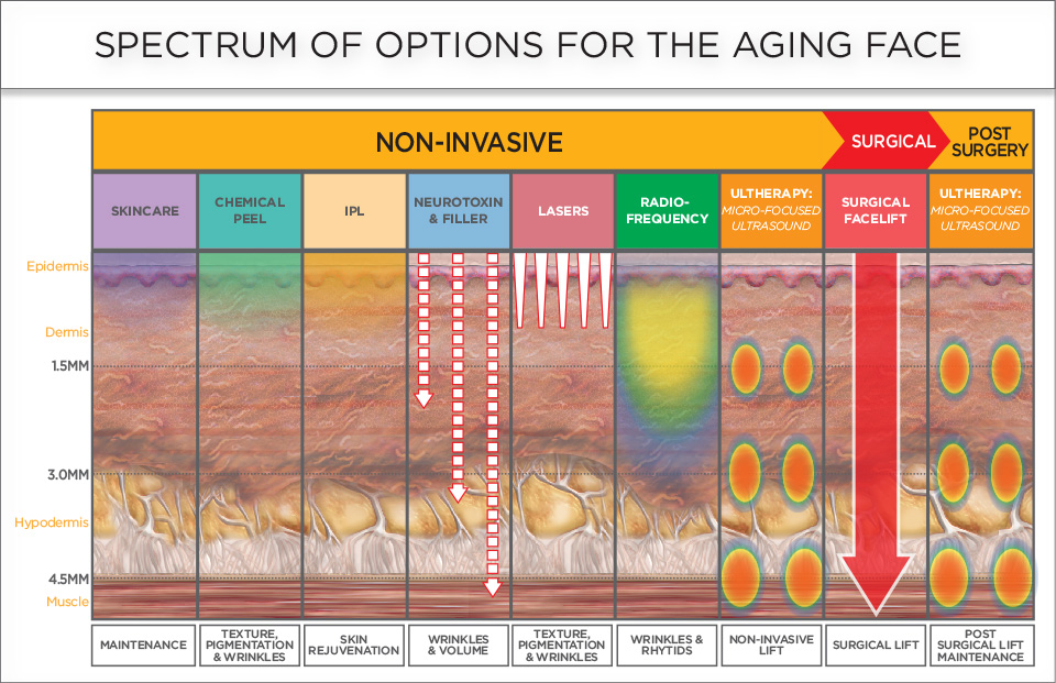 Treatment Options Aging Face Ultherapy Dr Siew