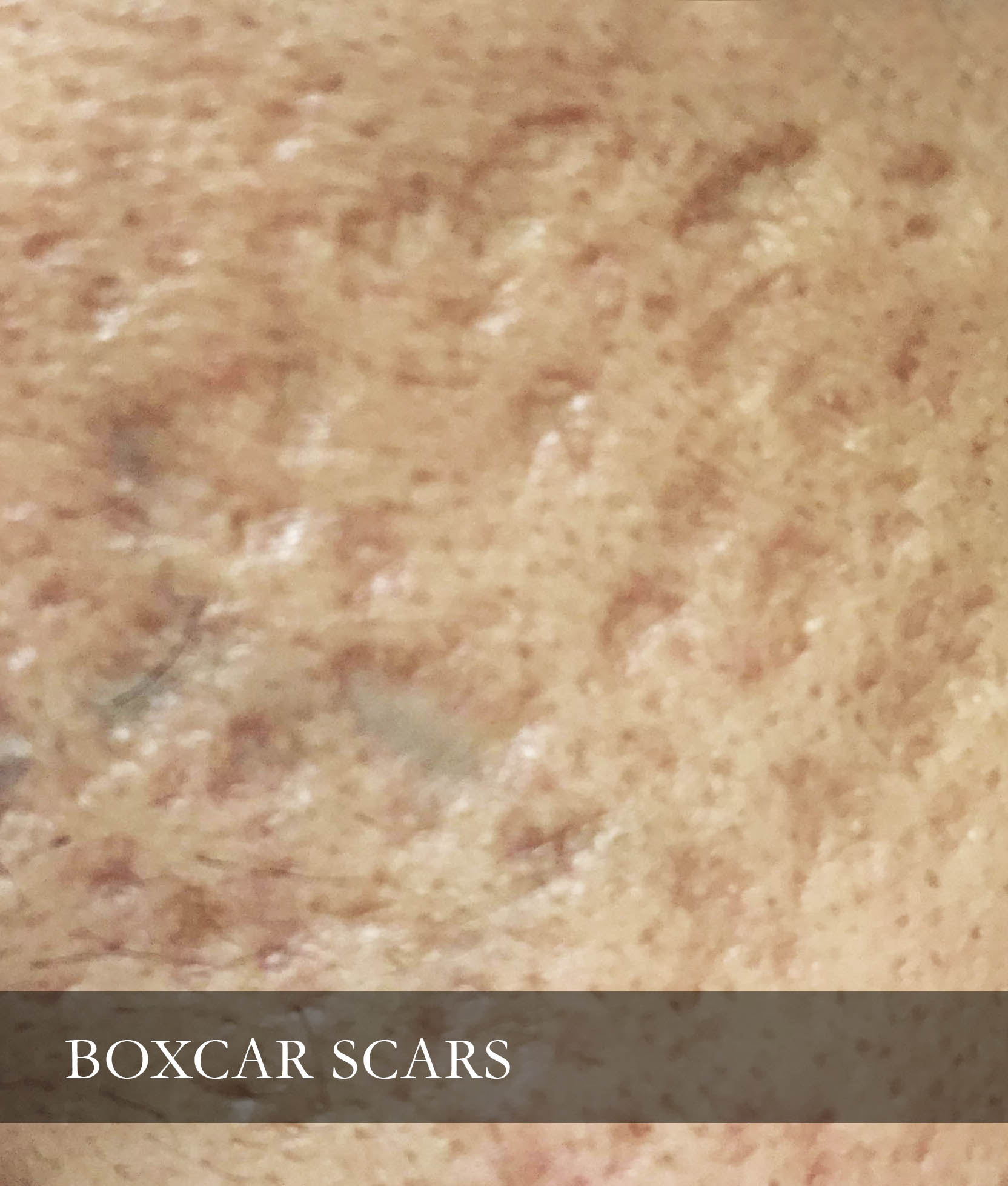 box-scar | Dr Siew.com