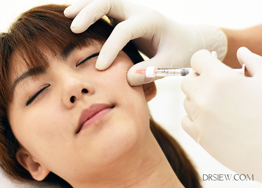 Everything you need to know dermal fillers Dr Siew