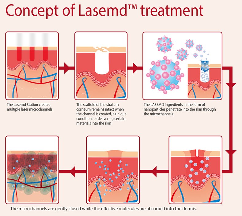 lasemd cosmeceutical delivery 